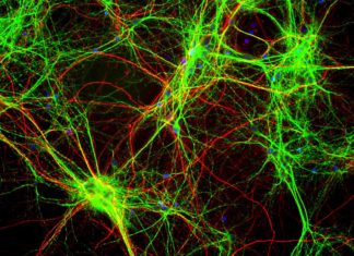 Allen Institute Shares First Open Database of Live Human Brain Cells
