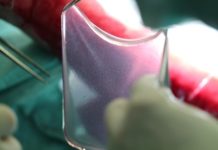 Skin damages : New solution using transplants derived from genetically modified stem cells