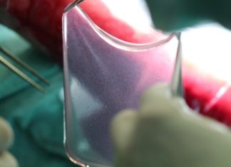 Skin damages : New solution using transplants derived from genetically modified stem cells