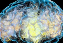 Here’s What We Think Alzheimer’s Does to the Brain