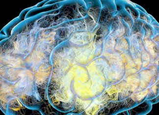 Here’s What We Think Alzheimer’s Does to the Brain