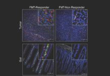 Bacteria in the gut modulates response to immunotherapy in melanoma