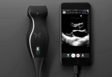 Butterfly iQ : portable ultrasound machine – smartphone-based