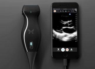 Butterfly iQ : portable ultrasound machine – smartphone-based