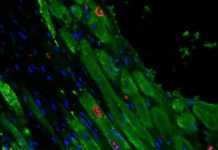 Injectable gel helps heart muscle regenerate after heart attack