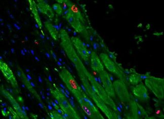 Injectable gel helps heart muscle regenerate after heart attack