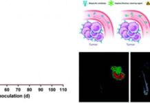 New system for treating colorectal cancer can lead to complete cure