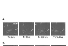 Old human cells rejuvenated in breakthrough discovery on aging