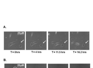 Old human cells rejuvenated in breakthrough discovery on aging