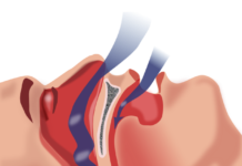 Synthetic cannabinoid reduces sleep apnea