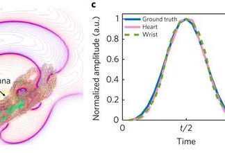 Developed a new way to monitor vital signs in patients without direct contact with the skin