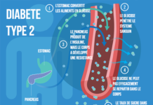 Study reveals how a very low calorie diet can reverse type 2 diabetes