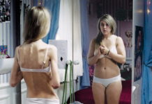 Obese and Anorexic Women Have Low Levels of Neurosteroid