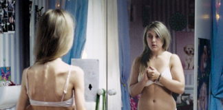 Obese and Anorexic Women Have Low Levels of Neurosteroid