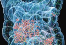 Age and Gut Bacteria Contribute to Multiple Sclerosis Progression