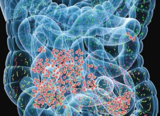 Age and Gut Bacteria Contribute to Multiple Sclerosis Progression