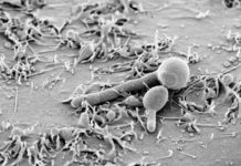 Identified the body’s defense mechanism against common oral ailment