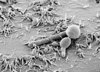 Identified the body’s defense mechanism against common oral ailment