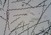 Tiny robots step closer to treating hard-to-reach parts of the body