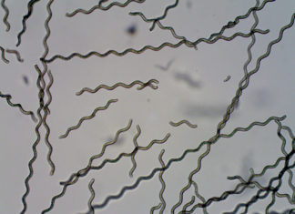 Tiny robots step closer to treating hard-to-reach parts of the body