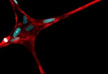 3-D printed microfibers could provide structure for artificially grown body parts
