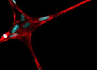3-D printed microfibers could provide structure for artificially grown body parts
