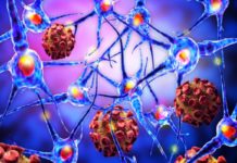 Cellular Self Digestion Process Triggers Autoimmune Disease