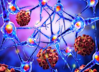 Cellular Self Digestion Process Triggers Autoimmune Disease