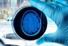 Inflammation drives progression of Alzheimer’s
