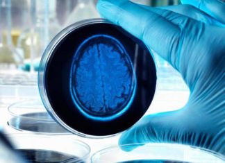 Inflammation drives progression of Alzheimer’s