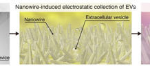 Nanowire device to detect cancer with a urine test