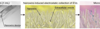 Nanowire device to detect cancer with a urine test