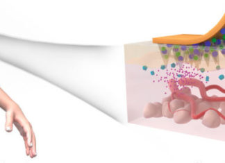 Pain-free skin patch responds to sugar levels for management of type 2 diabetes