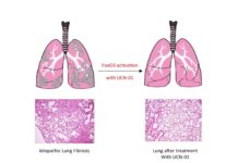 Pulmonary fibrosis caused by single transcription factor