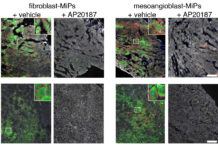 Scientists reprogram stem cells to regenerate muscle in muscular dystrophy