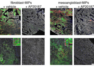 Scientists reprogram stem cells to regenerate muscle in muscular dystrophy