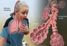 Study identifies new loci associated with asthma enriched in epigenetic marks