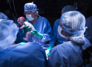 First baby from a uterus transplant in the US born in Dallas