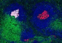 Overcoming difficulties developing an HIV vaccine