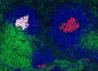 Overcoming difficulties developing an HIV vaccine