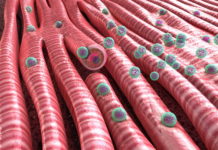 A nanoparticle inhalant for treating heart disease