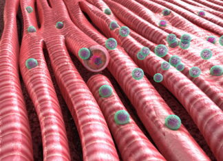A nanoparticle inhalant for treating heart disease