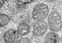 Anemia discovery offers new targets to treat fatigue in millions