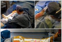 Augmented Reality helps surgeons to ‘see through’ tissue and reconnect blood vessels