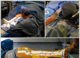 Augmented Reality helps surgeons to ‘see through’ tissue and reconnect blood vessels