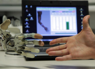 Bionic Reconstruction: Restoration at the Psychological Interface