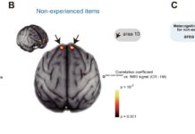 Cognitive Neuroscience and the Awareness of Ignorance
