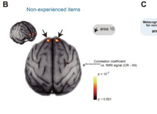 Cognitive Neuroscience and the Awareness of Ignorance