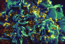 HIV-1 genetic diversity is higher in vaginal tract than in blood during early infection