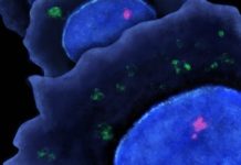 How cancer metastasis happens: Researchers reveal a key mechanism